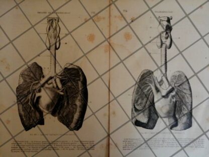 GRABADO MEDICO ANTIGUO 1877 SISTEMA RESPIRATORIO. /16